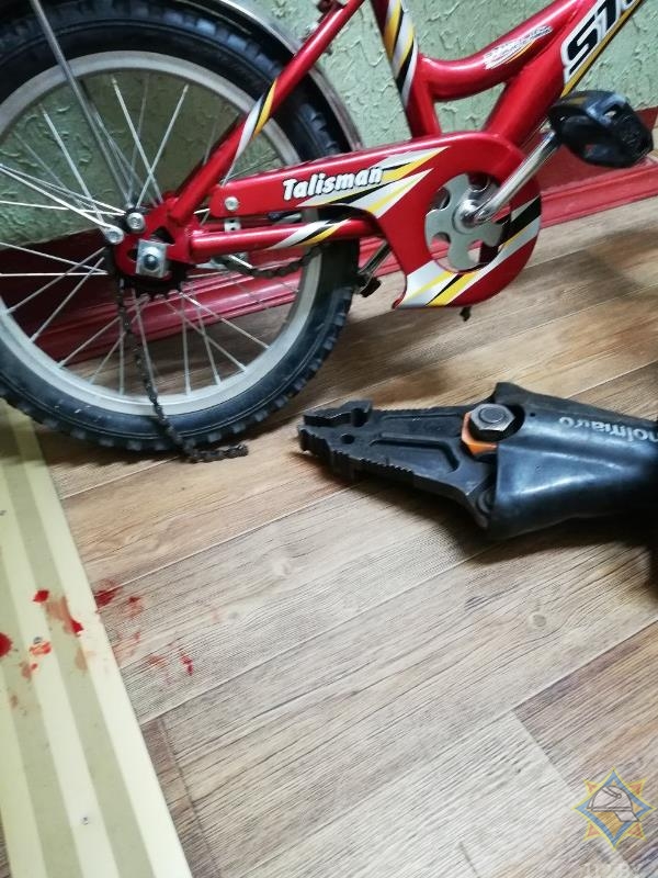 Ребенок в Витебске застрял в велосипедной цепи