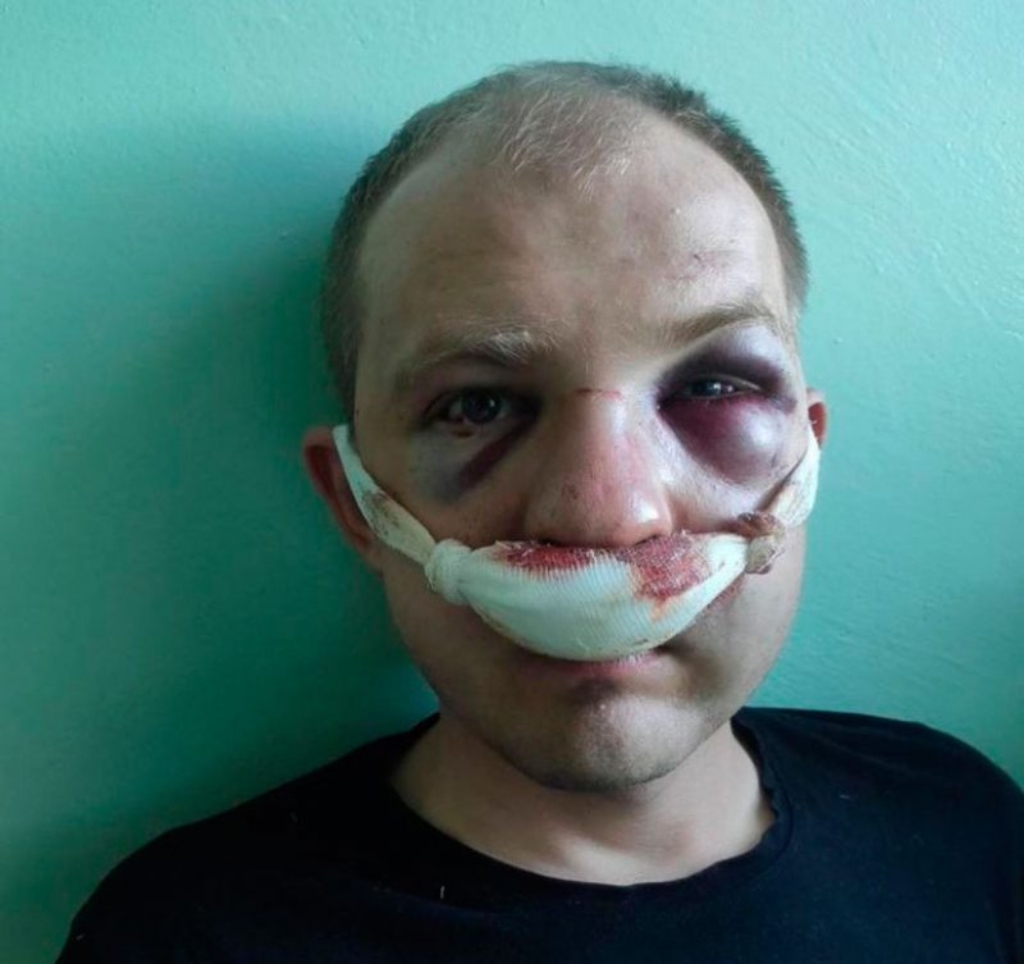 В Гродно объявили в розыск избитого силовиками таксиста, которого судят за насилие над милицией