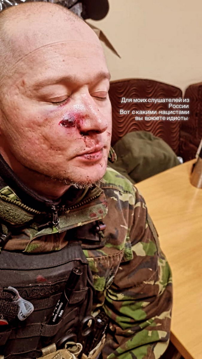 Лидер "Бумбокса" попал под обстрел в Украине