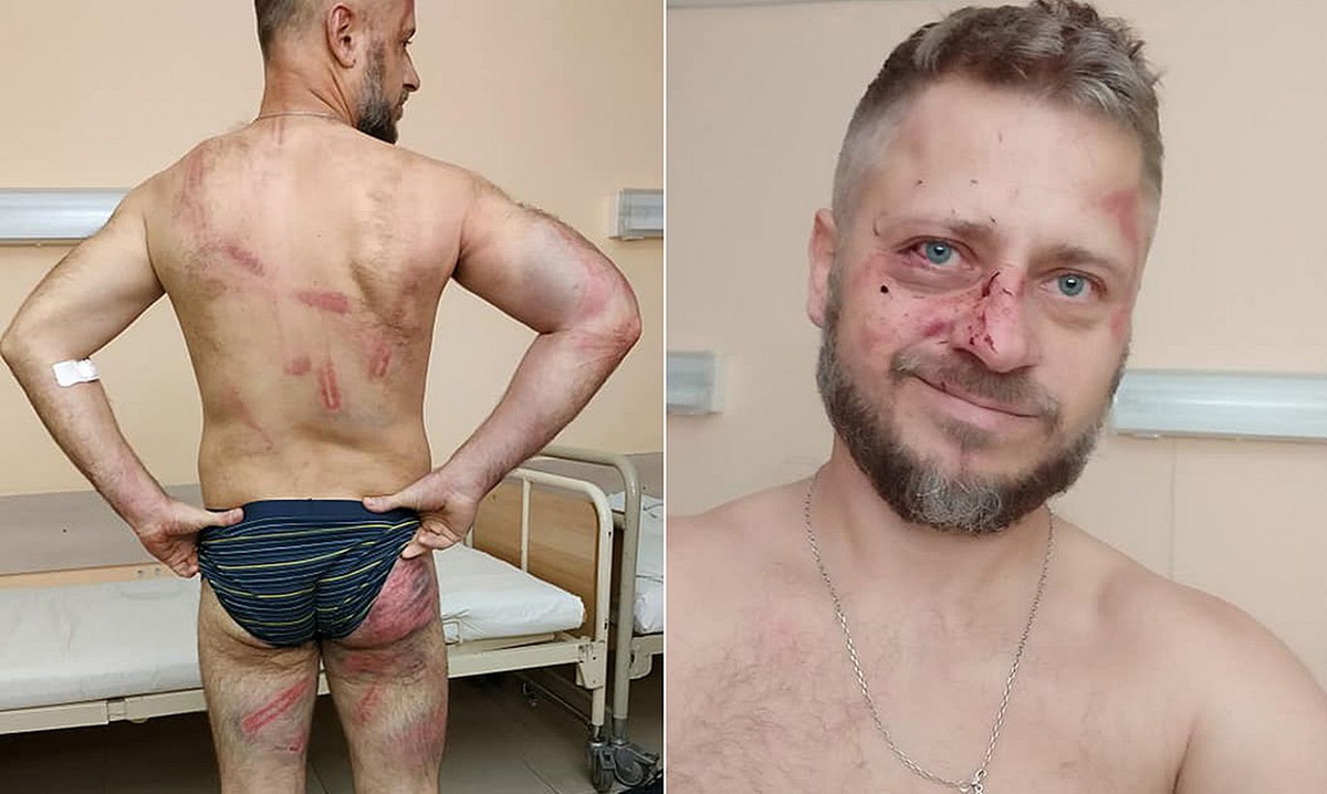 Задержан мужчина, избитый в 2020-м после того, как снял силовиков на видео