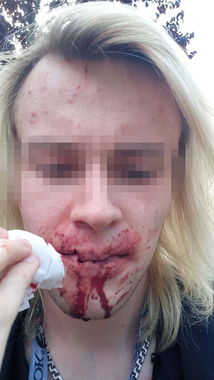 Журналиста Malanka Media избили в Вильнюсе