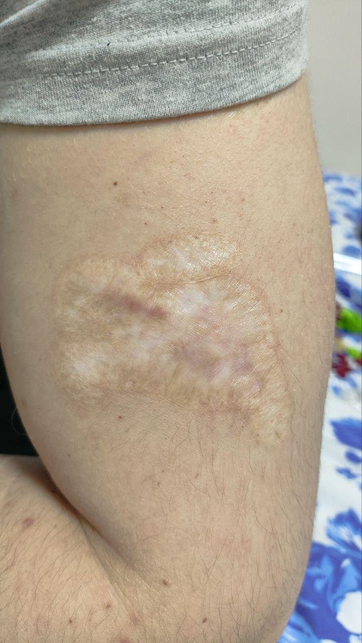 Илью Дубского вынудили в колонии самостоятельно удалить татуировку с "Погоней" — фотофакт